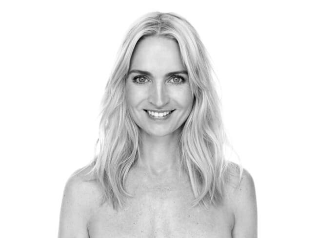 Annette Heick: Derfor får jeg kosmetiske behandlinger