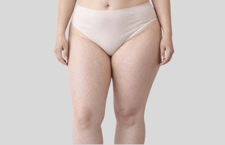 Inderlår på en kvinde i undertøj