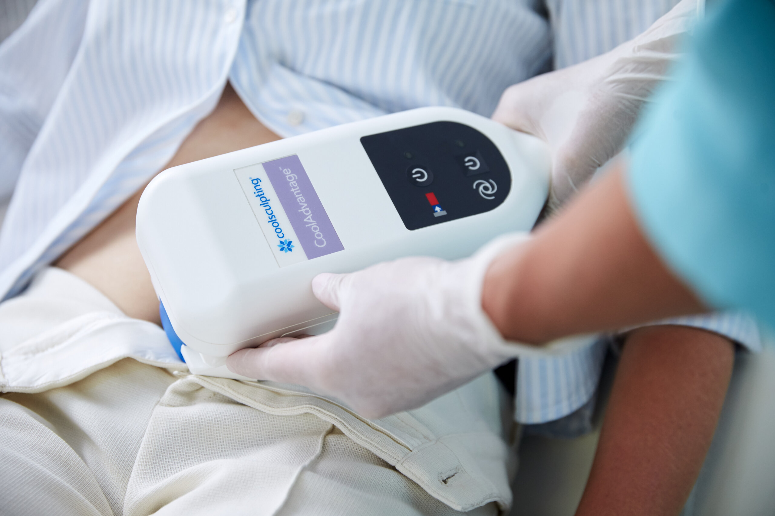 CoolSculpting
