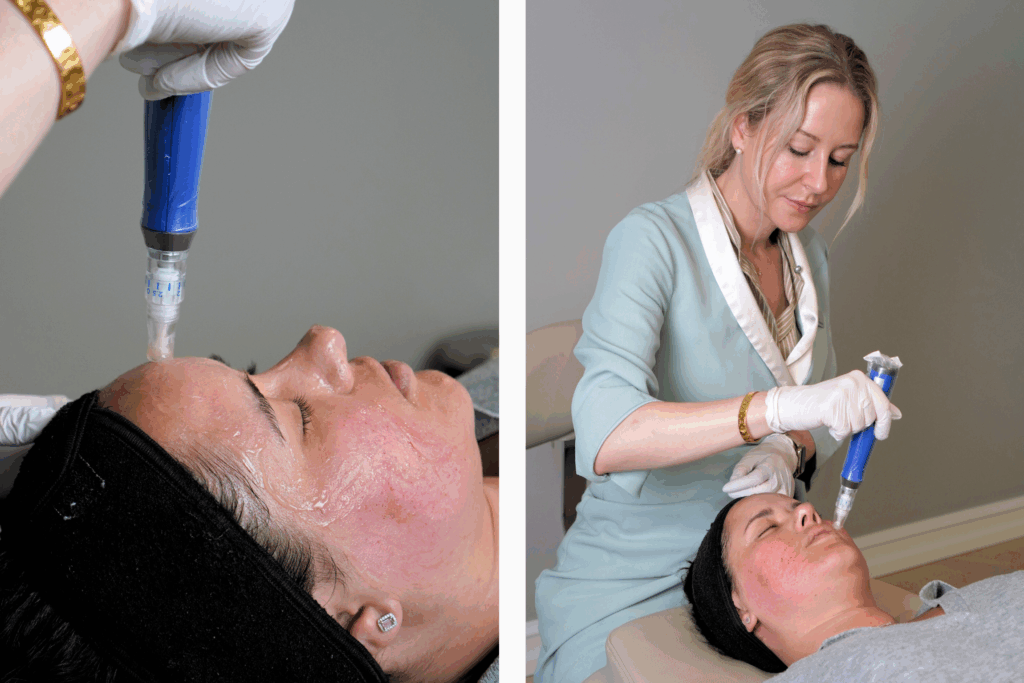 michala frøslev cancer nage