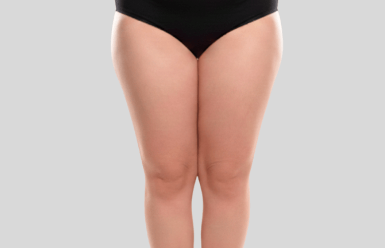 Billede af en kvinde med eksponeret ben