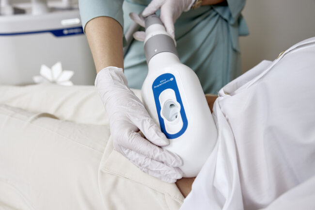 Billede af Mettes oplevelse med CoolSculpting